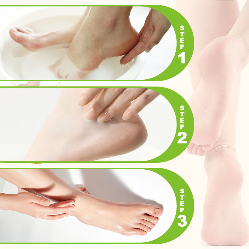 1 + 2 FREE TODAY | HeelRescue™ - Foot Cream