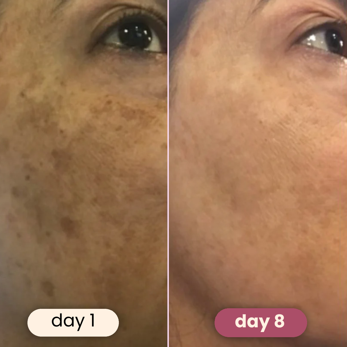 50% OFF TODAY | SpotFade™ - Brightening Pads