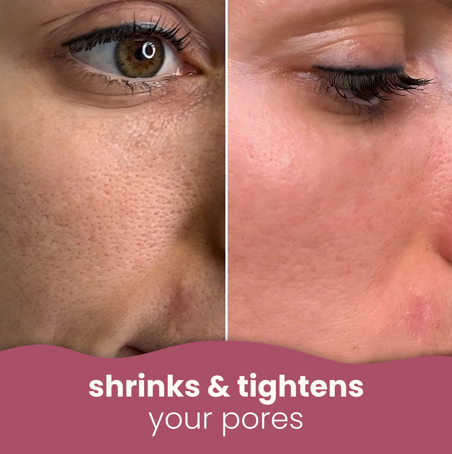 50% OFF TODAY | SpotFade™ - Brightening Pads