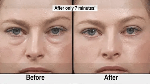 50% OFF TODAY  YouthfulAura™ - Comfortable Facial Lift