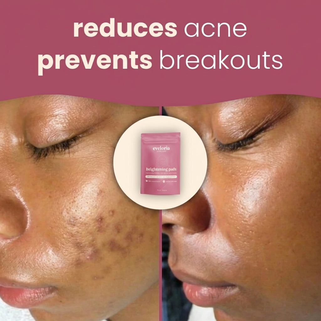 50% OFF TODAY | SpotFade™ - Brightening Pads